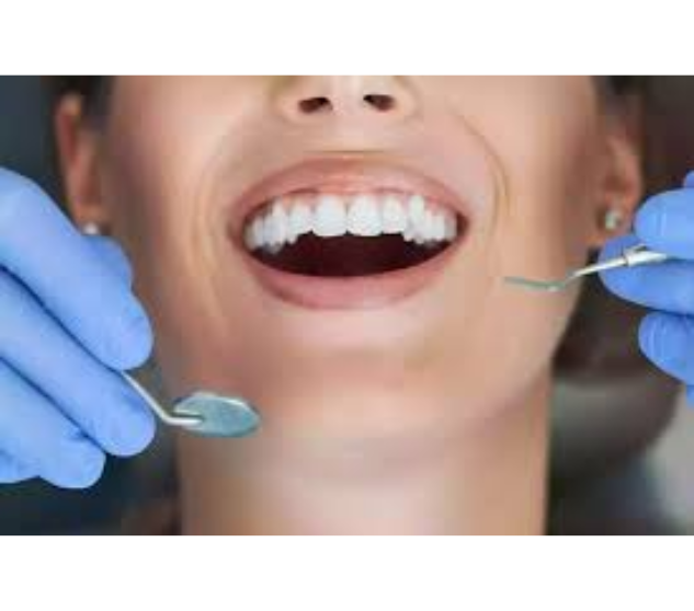 What is the service?