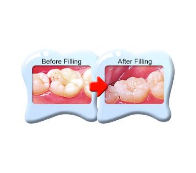 What is the service?