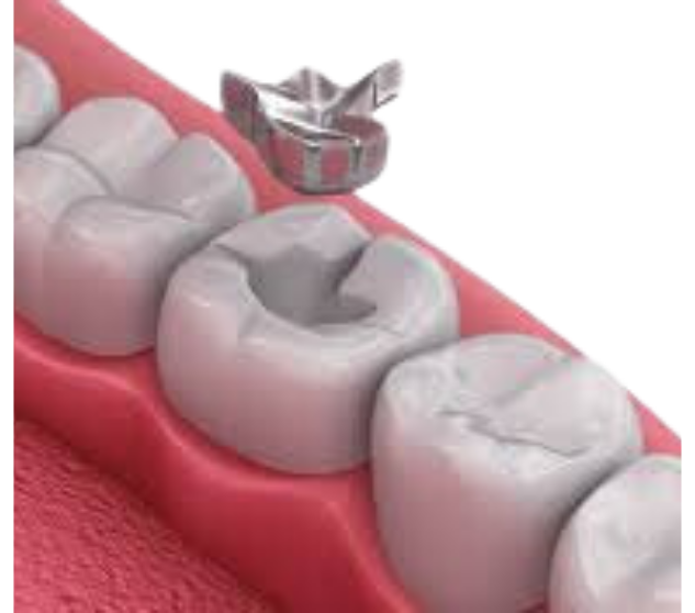 What is the service?