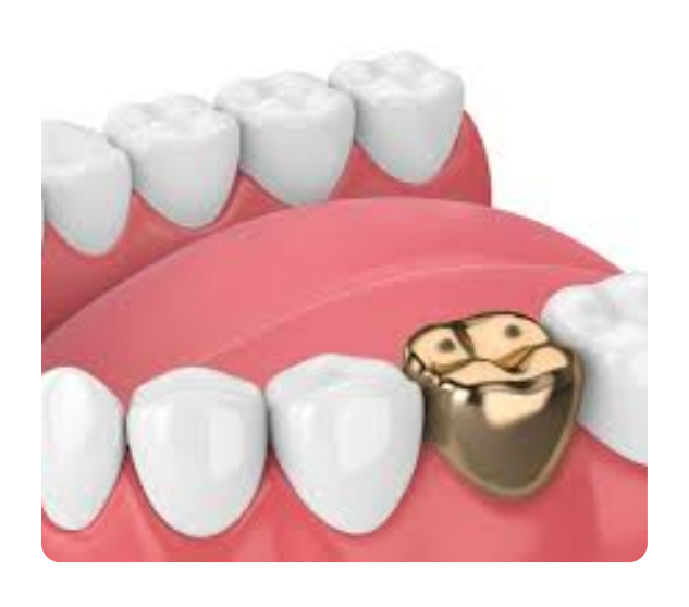 What is the service?