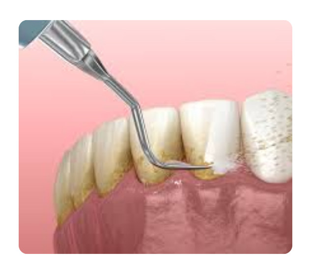 What is the service?