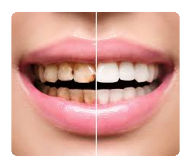 What is the service?