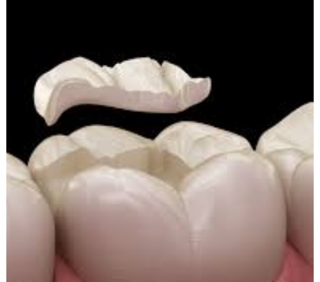 What is the service?